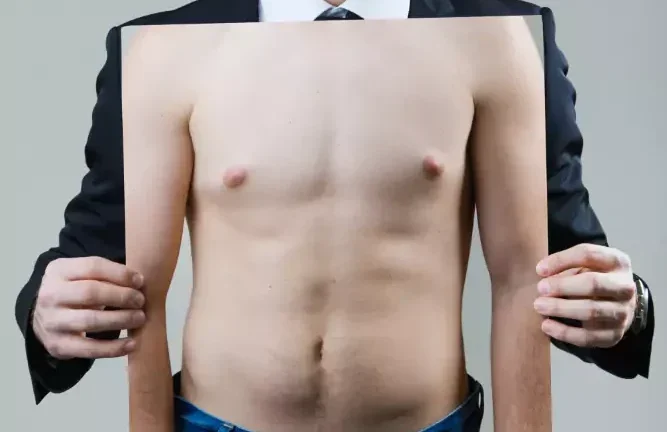 Gynecomastia Correction