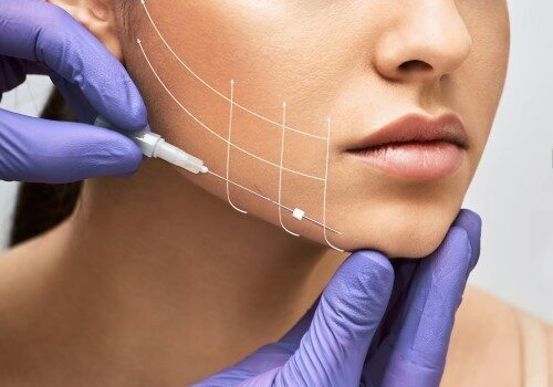 Thread Lift_ An Anti-Aging Revolution